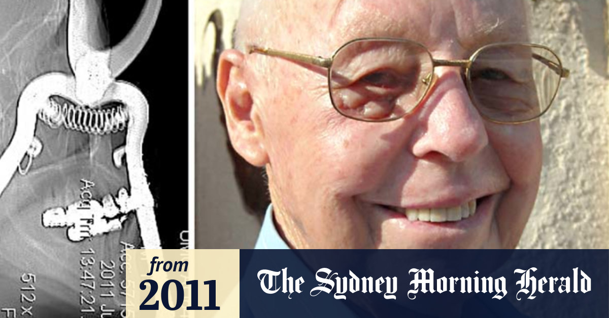 Video Doctor and patient describe shear luck